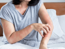 Bí quyết chọn nệm cho người bị dị ứng, da nhạy cảm